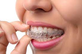 What Is Bruxism and How Teeth Guards Can Help
